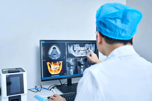 Best Emergency Dental Care for Broken or Chipped Teeth in West Liberty, IA
